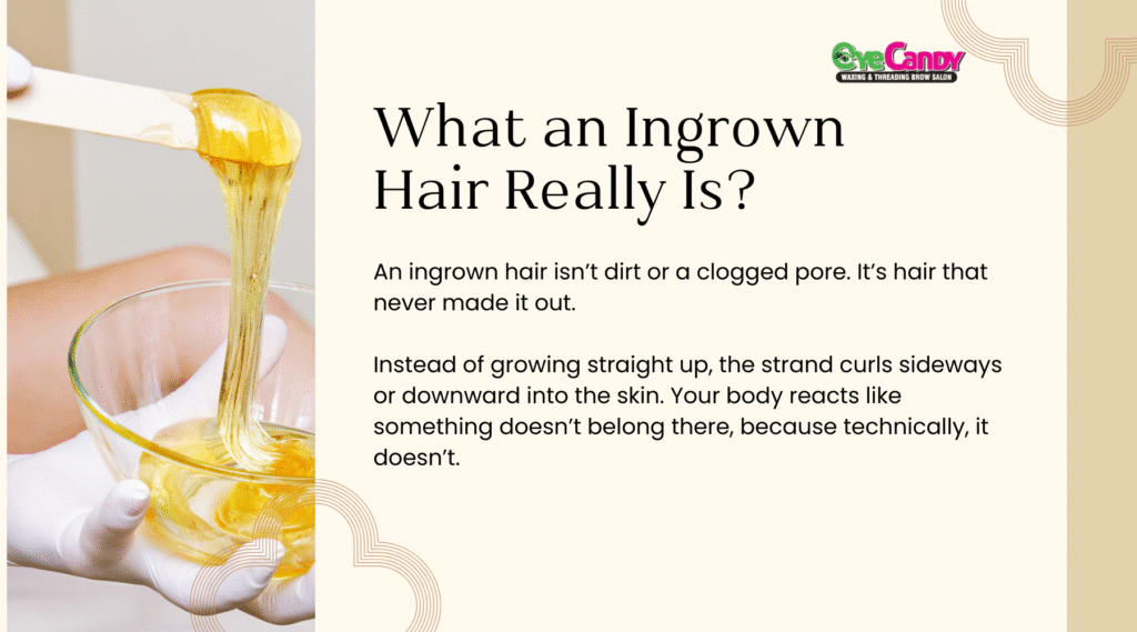 How to Remove Ingrown Hair Safely